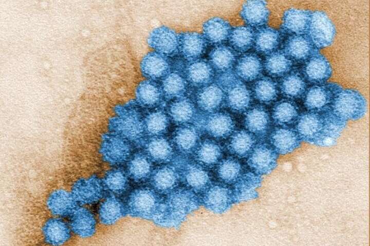 Cluster of norovirus virions. Credit: CDC