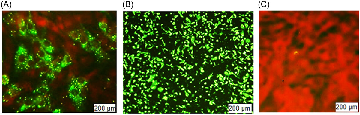 iid31198-fig-0005-m